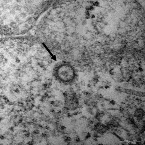 27일 질병관리본부가 공개한 국내 신종코로나바이러스감염증 확진자 6명으로부터 확보한 '코로나19 바이러스(SARS-CoV-2)'를 전자현미경으로 관찰한 사진. [사진=질변관리본부]